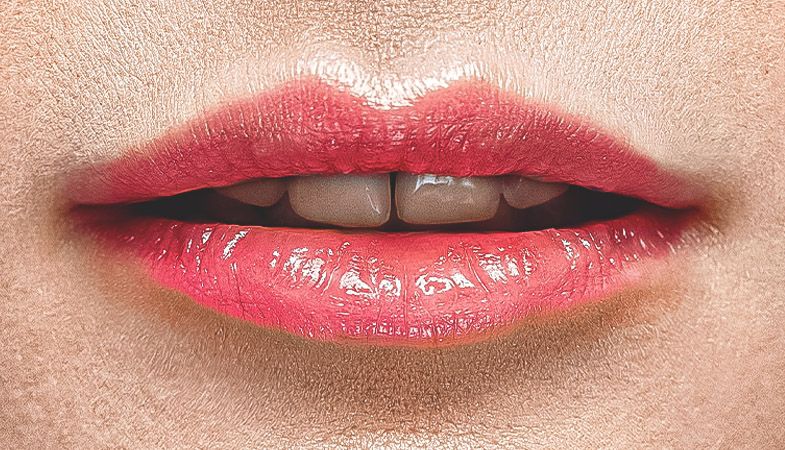 Aumento labios imagen antes