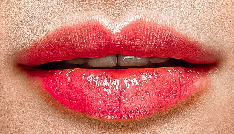 Aumento labios imagen depues
