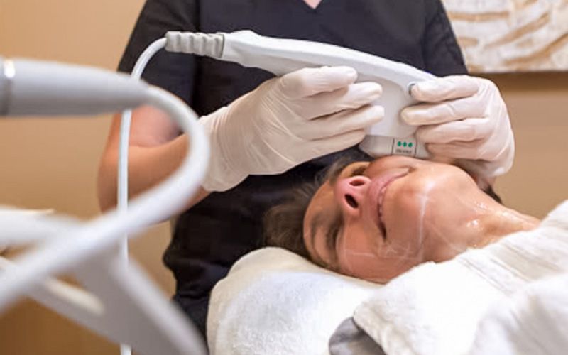Ultherapy contacto timeless