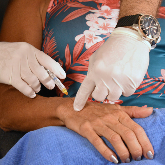 Biostimulators