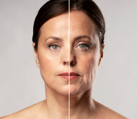 before after Aesthetic Clinic Playa del Carmen